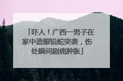 吓人！广西一男子在家中遭眼镜蛇突袭，伤处瞬间剧痛肿胀