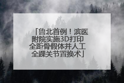 鲁北首例！滨医附院实施3D打印全距骨假体并人工全踝关节置换术